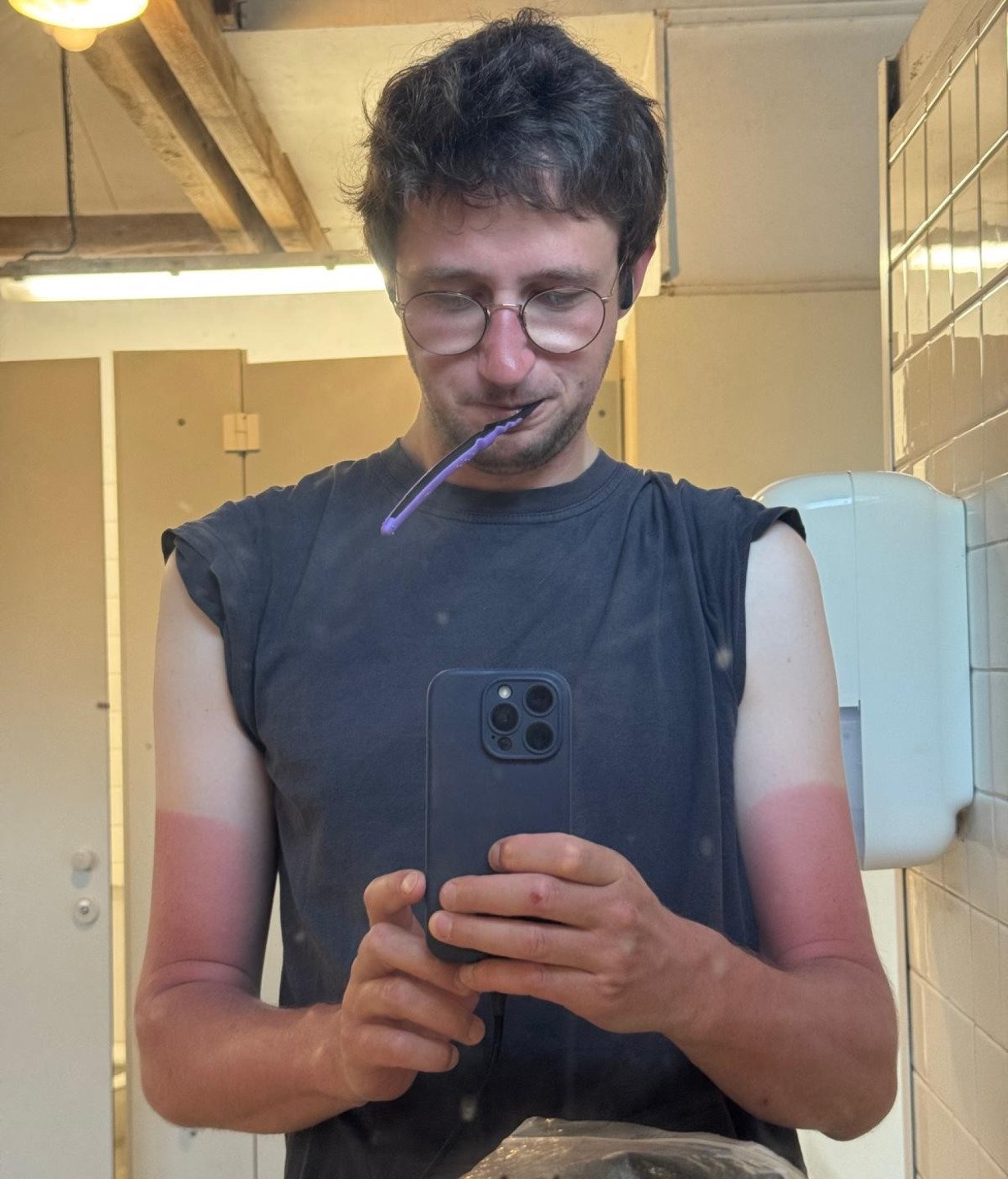 Coup de soleil vaille fraise